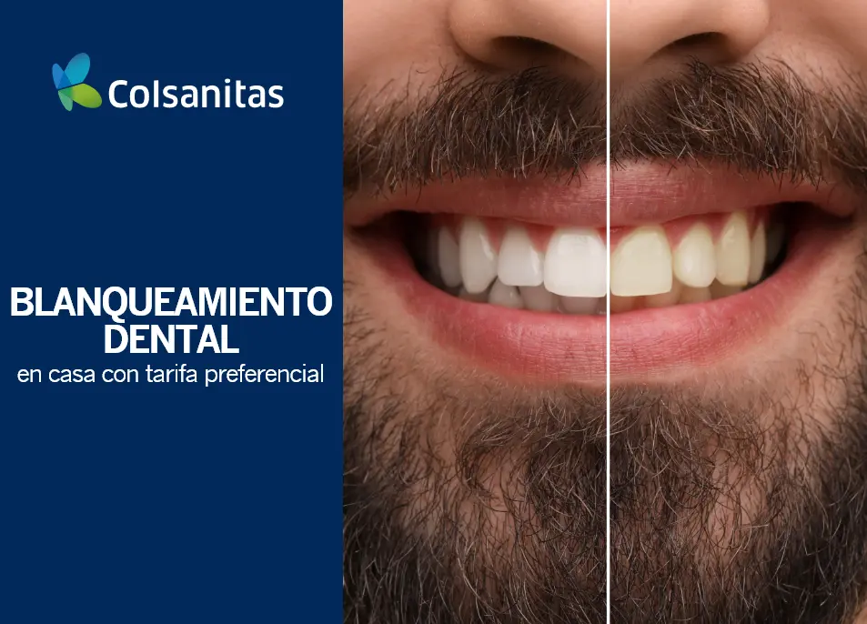 clincas-dentales-blanque-dental-casa-tarifa-pref-442000